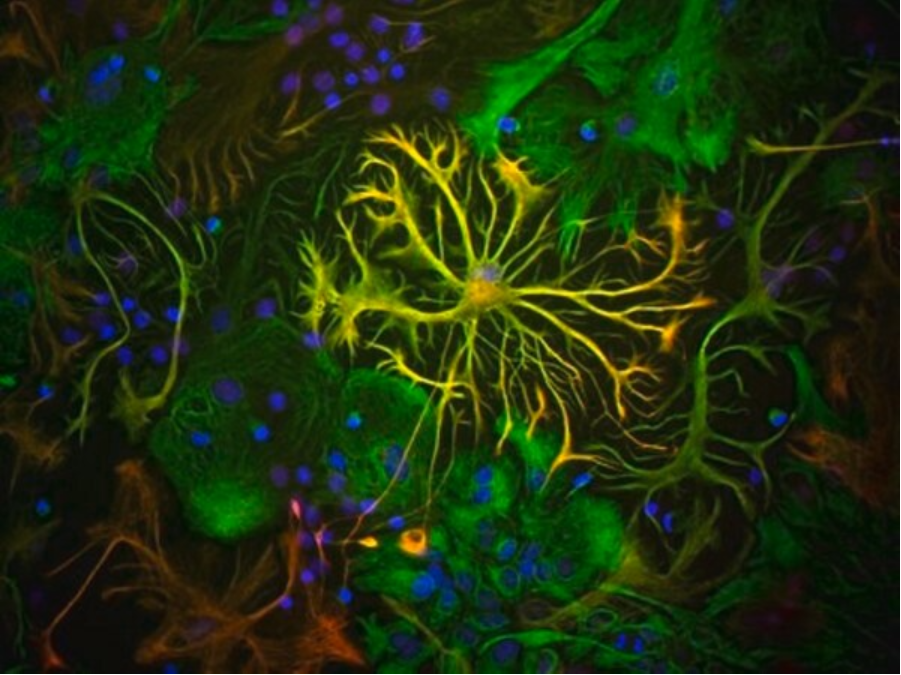 Sigma货号AB5541抗胶质纤维酸性蛋白抗体136116