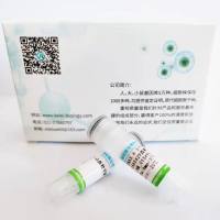 pT/Caggs-NRASV12-诱导肝癌模型的质粒