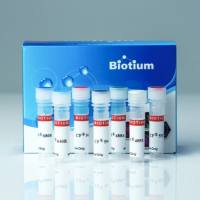 Prostate Specific Antigen (PSA) (KLK3/2871R), CF