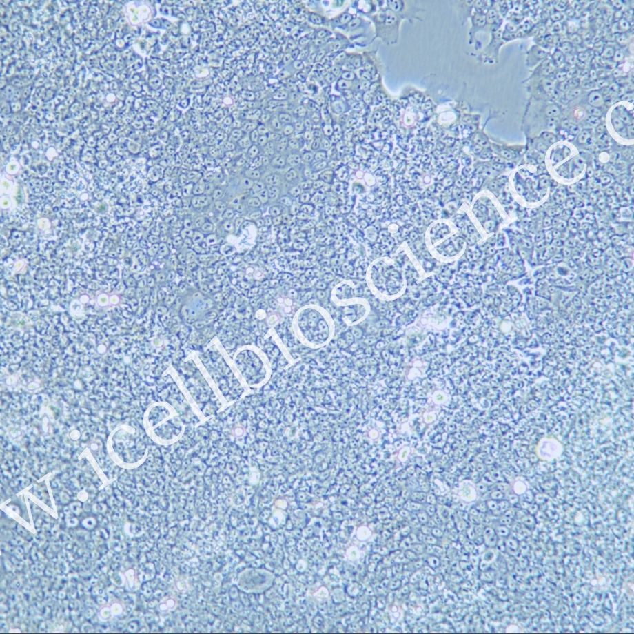 SNU-81细胞 | SNU81细胞 | SNU-81 | SNU81 | 人结肠腺癌细胞 | STR鉴定 | 镜像绮点(Cellverse)