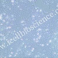 SNU-81细胞 | SNU81细胞 | SNU-81 | SNU81 | 人结肠