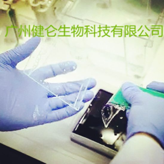 肺炎衣原体IgM-IFA荧光玻片法检测试剂盒