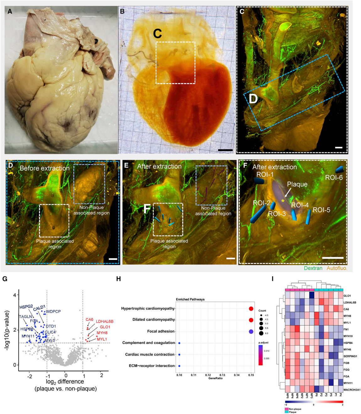 cell丨基于组织透明化技术的完整器官空间蛋白组学研究