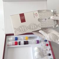 Borna Disease Virus(BDV)博尔纳病病毒探针法荧光定量RT-PCR试剂盒