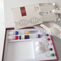 Yellow-Head Baculovirus(YBV)黄头杆状病毒探针法荧光定量RT-PCR试剂盒