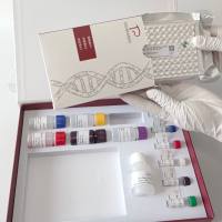 Isospora suis猪等孢球虫探针法荧光定量PCR试剂盒