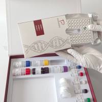 Influenza Virus C丙型流感病毒探针法荧光定量RT-PCR试剂盒