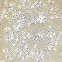 MDA-MB-231hSTK39KO基因过表达稳转株