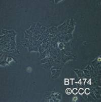 BaF3细胞EGFR-595S基因过表达稳转株