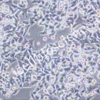 SK-CO-1 人结直肠腺癌细胞/STR鉴定/镜像绮点(Cellverse)