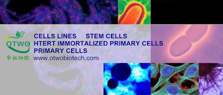 MKN45人低分化胃癌细胞|MKN45细胞(Human Po