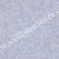 ARH-77 人外周血淋巴细胞/STR鉴定/镜像绮点（Cellverse）