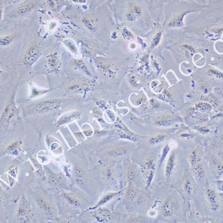 SNU-423 | SNU-423细胞 | SNU423 | SNU423细胞|SNU423人肝癌细胞 | STR鉴定 | 镜像绮点(Cellverse)