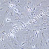 SNU-423 | SNU-423细胞 | SNU423 | SNU423细胞|SNU423人肝癌细胞 | STR鉴定 | 镜像绮点（Cellverse）