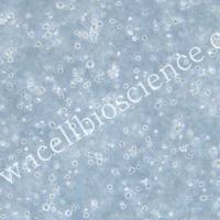 IM-9细胞、IM9细胞、IM-9、IM9、人外周血B淋巴细胞/STR鉴定