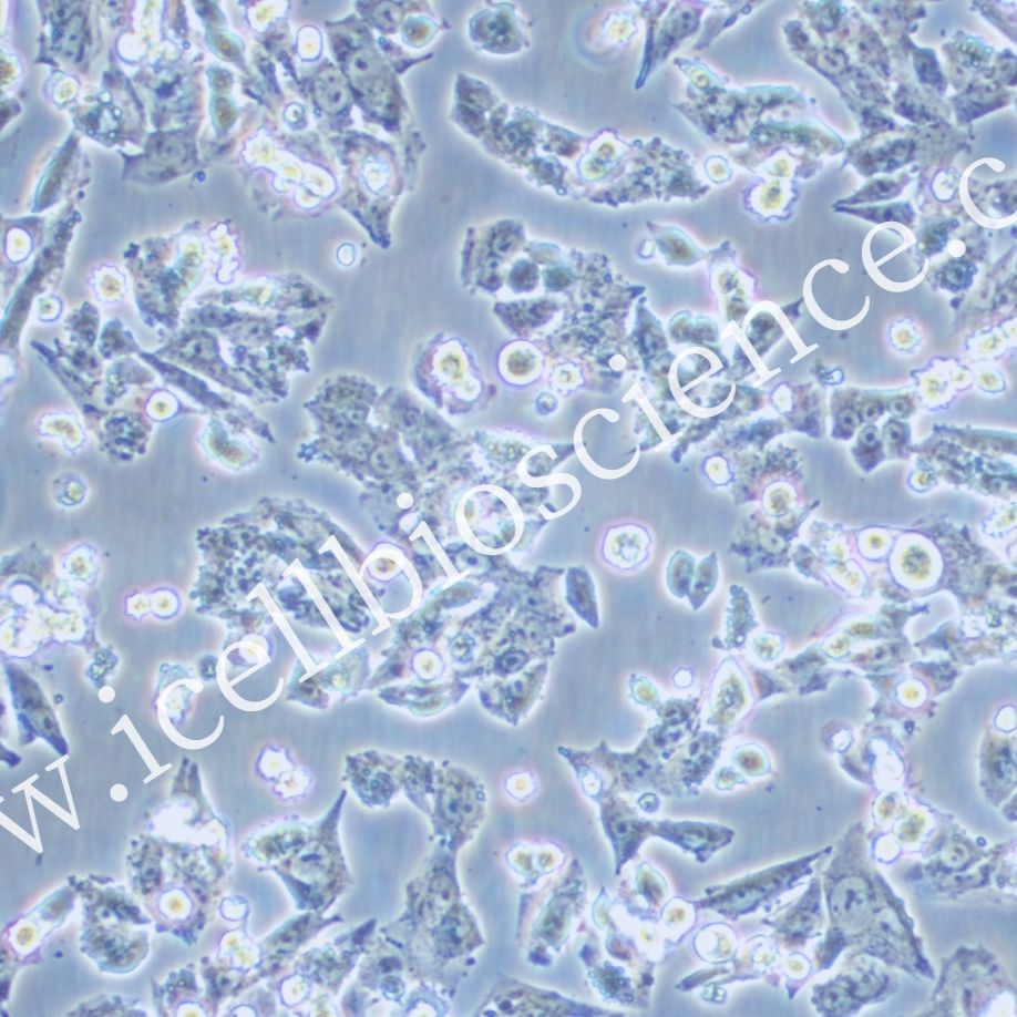 Y-1(Y1) 小鼠肾上腺皮质瘤细胞/STR鉴定