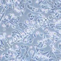 Y-1(Y1) 小鼠肾上腺皮质瘤细胞/STR鉴定