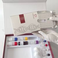 Trichuris ovis绵羊鞭虫探针法荧光定量PCR试剂盒