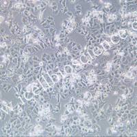 A-427 人肺癌细胞/STR鉴定/镜像绮点(Cellverse)