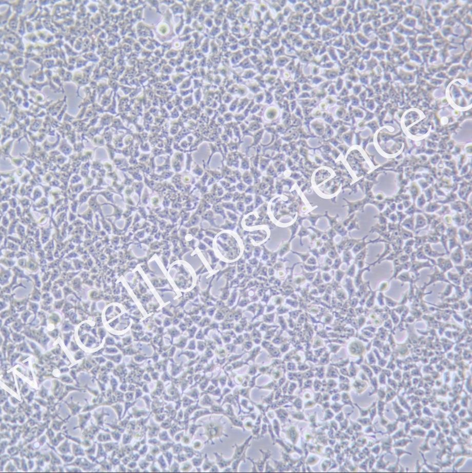 Lenti-X293T、Lenti-X293T细胞、LentiX293T细胞、LentiX293T、人胚肾细胞/STR鉴定