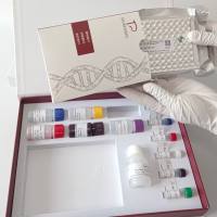 Mycobacterium xenopi蟾分枝杆菌探针法荧光定量PCR试剂盒