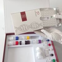 Egg Drop Syndrome Virus-1976(EDSV-76)鸡减蛋综合征病毒-1976探针法荧光定量PCR试剂盒