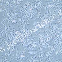 SJCRH30 人骨髓横纹肌肉癌细胞/STR鉴定/镜像绮点(Cellverse)