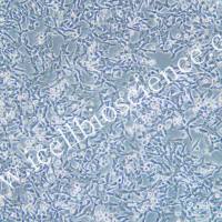 SNU-638细胞 | SNU-638 | SNU638细胞 | SNU638 | 人