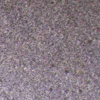 SU-DHL-1人间变性大细胞淋巴瘤细胞_SU-DHL-1细胞(STR鉴定)