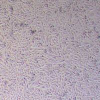 143BTK-人胸腺激酶缺陷细胞_143BTK-细胞(STR鉴定)