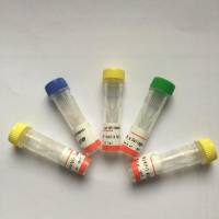 抗伤寒杆菌H血清抗体