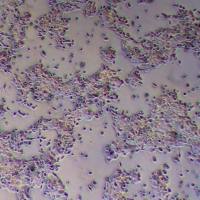 OE-33人食管腺癌_OE-33细胞(STR鉴定)