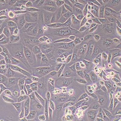 SNGM人子宫内膜腺癌细胞_SNGM细胞(STR鉴定)