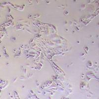 HCC1171人肺癌腺癌贴壁细胞_HCC1171细胞(STR鉴定)