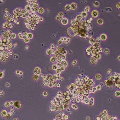 OCUM-1人胃癌细胞_OCUM-1细胞(STR鉴定)