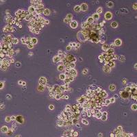 OCUM-1人胃癌细胞_OCUM-1细胞(STR鉴定)