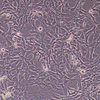 12Z人子宫内膜异位细胞_12Z细胞(STR鉴定)