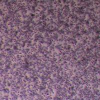 AKR小鼠食管癌细胞__AKR细胞(种属鉴定)