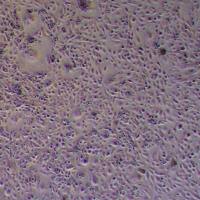 EFO-27人卵巢腺癌细胞_EFO-27细胞(STR鉴定)