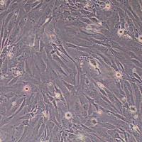 人真皮毛乳头细胞永生化_细胞(STR鉴定)