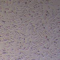 SW1088人脑星形胶质瘤细胞_SW1088细胞(STR鉴定)