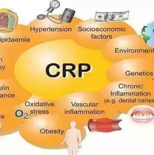 SAA CRP血球、特定蛋白大包装试剂