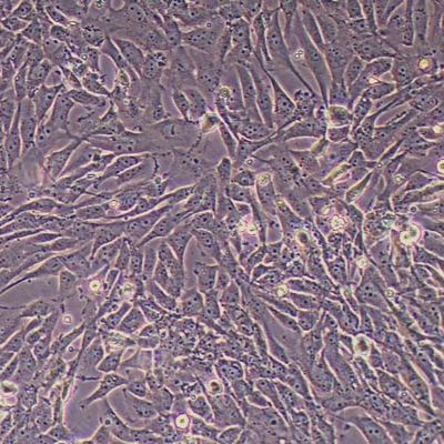 SW1783脑星形细胞瘤 _SW1783细胞(STR鉴定)