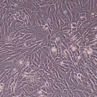 SW1783脑星形细胞瘤 _SW1783细胞(STR鉴定)