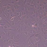 HDQ-P1人乳腺癌细胞_HDQ-P1细胞(STR鉴定)