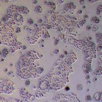 caov-4人卵巢癌细胞_caov-4细胞(STR鉴定)