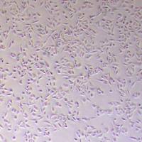 NCI-H596人肺腺鳞癌细胞_NCI-H596细胞(STR鉴定)