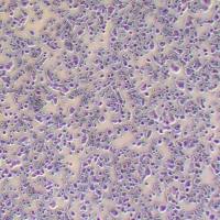 NCI-H1944 人肺癌细胞_NCI-H1944细胞(STR鉴定)