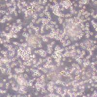 RI-1人B细胞淋巴瘤细胞系_RI-1细胞(STR鉴定)