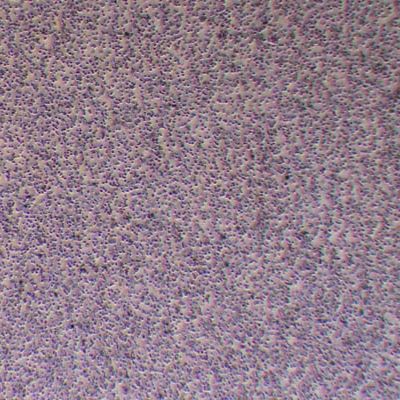 RS4:11人急性淋巴细胞白血病_RS4:11细胞(STR鉴定)